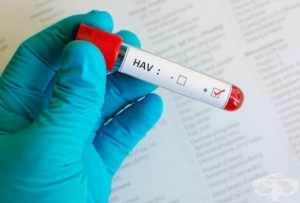 Хепатит А се разпространи в над 20 училища и детски