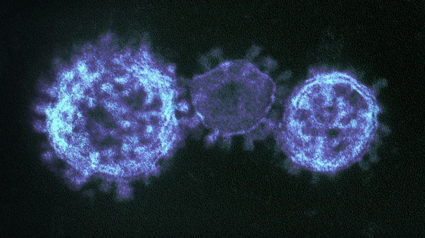 Италиански учени успяха да изолират коронавируса съобщи министърът на здравеопазването