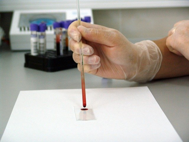 Русия оповести че е започнала да тества върху животни ваксина срещу