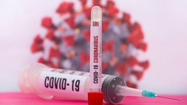 283 са положителните тестове за коронавирусна инфекция от направени общо
