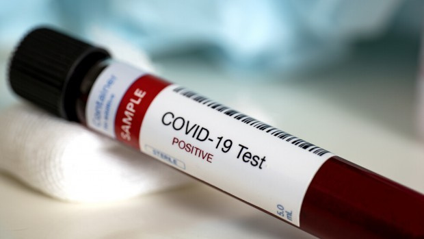 3414 са новите случаи на заразени с коронавирус в България за