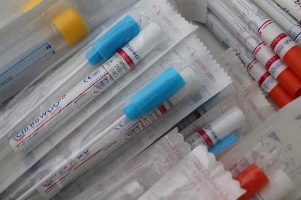Европейската комисия прие препоръки за използването на бързите антигенни тестове