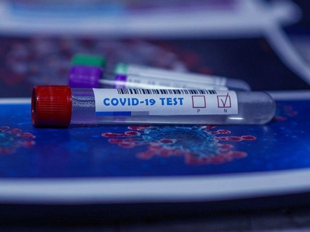 Първи опит за измама с отрицателни PCR тестове В схемата