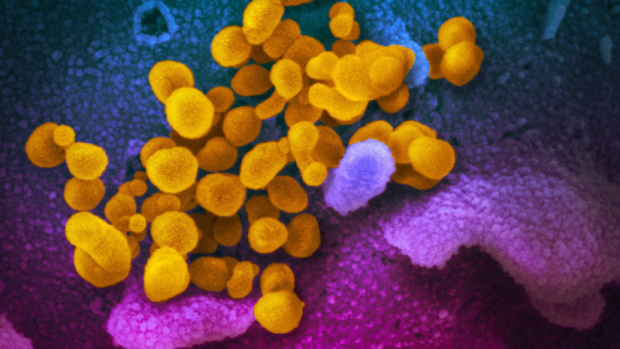 Учени от САЩ установиха че новият коронавирус може да увреди