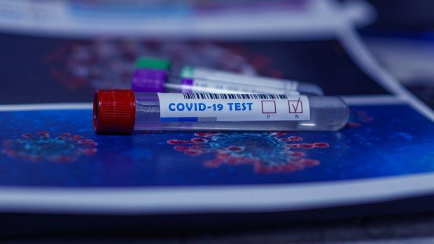 Разходите за PCR тестове на служители командировани в чужбина ще се