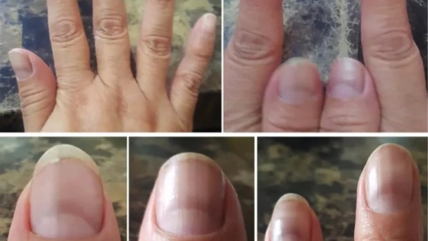 Учените твърдят, че състоянието на ноктите ни може да се