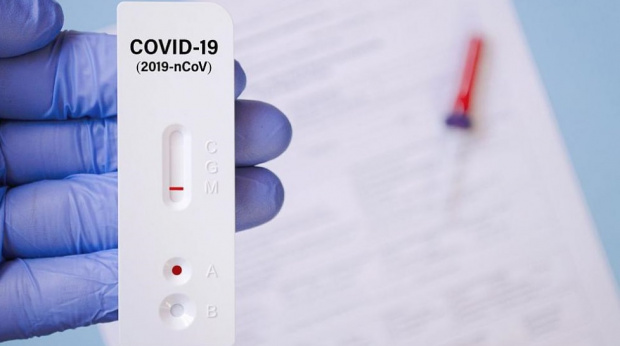 1033 са новите случаи на COVID 19 у нас сочат данните