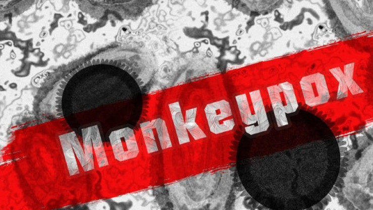 Скок на случаите на маймунска шарка в Европа