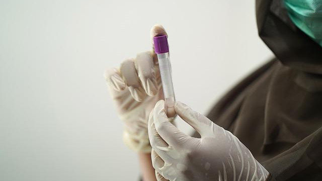 Епидемичен взрив от хепатит в Монтана, БЧК с бързи мерки