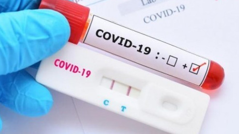 Ковид-19 за 24 часа: 4-ма починали, 157 новозаразени и 177 ваксинирани