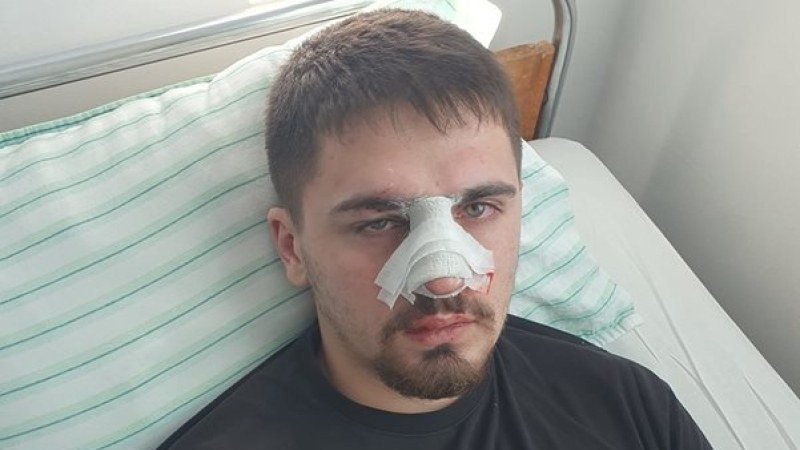 Бащата на пребития младеж в Плевен: Полицаите спрели побоя, чак когато си е глътнал езика