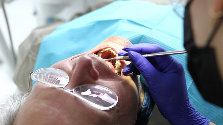 Цените при зъболекарите скочиха двойно