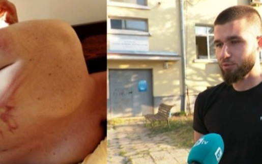5 полицаи в Козлодуй бият и гаврят младо момче със сърдечни проблеми