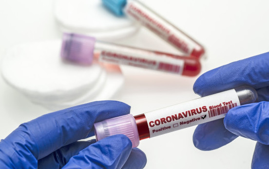 100% от 16-те починали от К-19 за денонощието са били неваксинирани