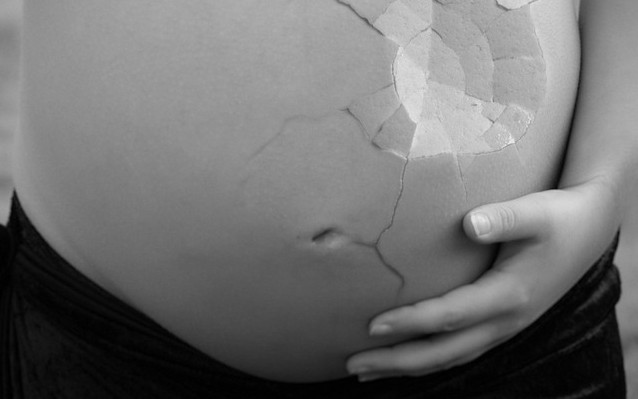 Факти за абортите, които НЕ знаете