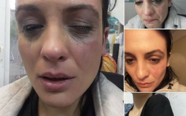 Скандално! Актрисата Диана Димитрова разказа за насилие по време на снимки