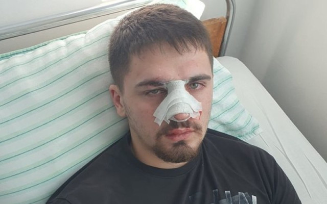Бащата на пребития младеж в Плевен: Полицаите спрели побоя, чак когато си е глътнал езика