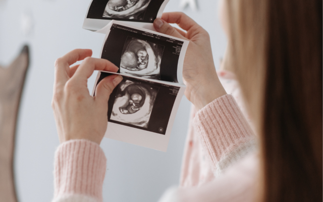 Странни факти за бременността и бебетата, за които не се говори често