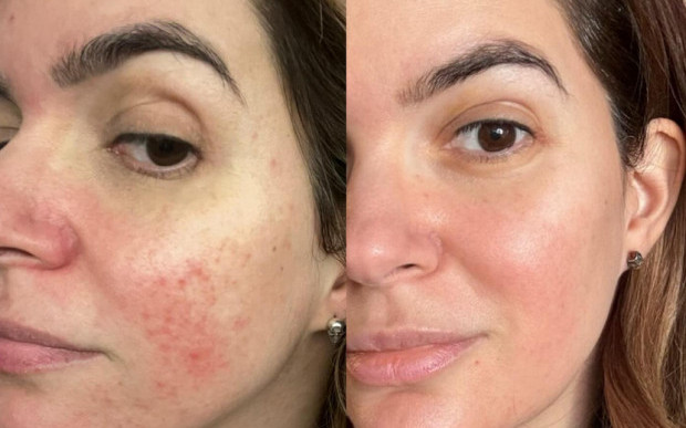 Ива Софиянска се излекува