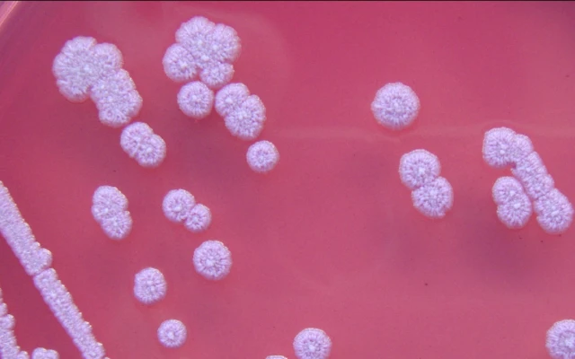 Бактерия, предизвикваща сепсис, убива маймуни в Хонконг