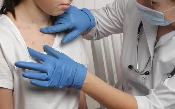 Заразени с морбили вече има и в София, случаите растат