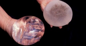 Турция препоръча махане на фалшивия силикон