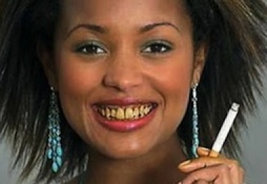 Тютюнопушенето и влиянието му върху зъбите, венците и устната кухина