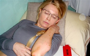 Неизвестна кожна болест мъчи Юлия Тимошенко