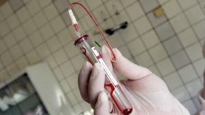 1600 българи ХИВ-позитивни, 112 са заболелите през 2012 г.