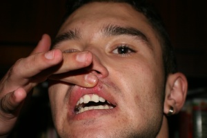 Братя, избили зъбите на 17-годишен, отказват да признаят вина