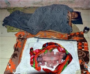 Индийка стресна лекарите – роди сиамски близнаци по естествен път