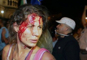 Петима пострадали при протеста са минали през „Пирогов”