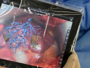 Приложение за iPad на Fraunhoffer ще помага на хирурзи при операции