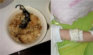 Майка откри мишка в храната на детето си в болница в Пловдив