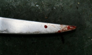 Намушканото момче от Пловдив вече диша без апарат