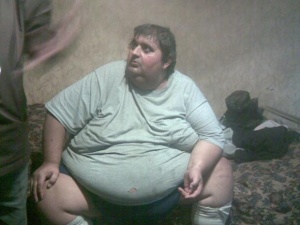 Най-тежкият българин търпи нечовешки болки