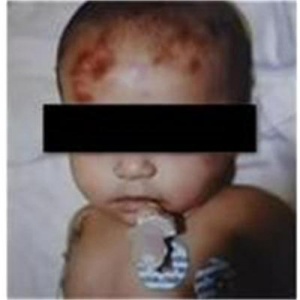 Още се борят за живота на пребитото бебе Йордан