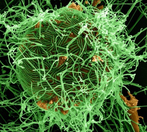 Кръвта на оцелелите от ебола ще отива за лечение на болни хора