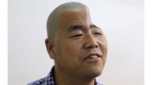 Лекари възстановиха череп на китаец с 3D принтер (снимки)