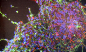 Откриват център по клетъчна терапия във Варна