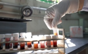 Ново лекарство бори рака на простатата