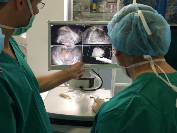 Диагностичен апарат  хваща  в зародиш рака на простатата
