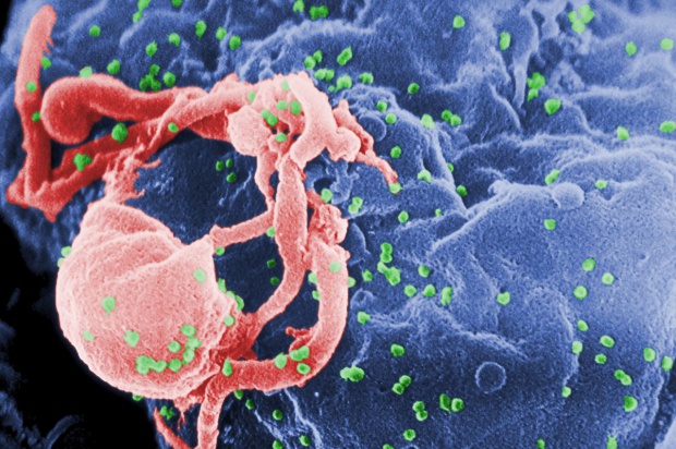 Първи случай на СПИН в Монтанско