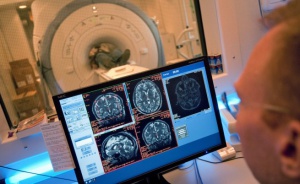 Учени доказаха: размерът на мозъка определя интелигентността