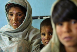 Епидемия мори хората в Сирия, здравната система е срината