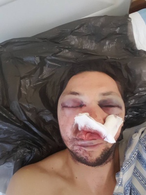 Журналист в Поморие пребит жестоко с бухалки