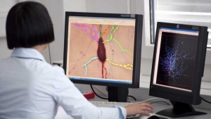 Алцхаймер и Паркинсон ще се лекуват с изкуствени невронни мрежи