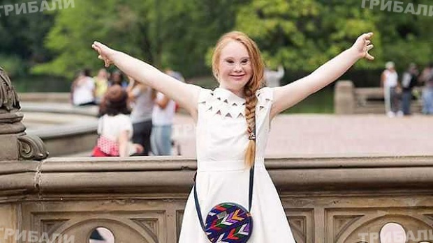 Днес е световен ден на хората със Синдром на Даун