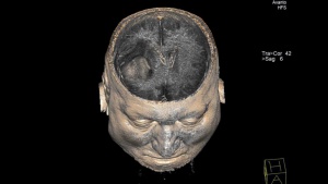 Работата на смени вреди на мозъка