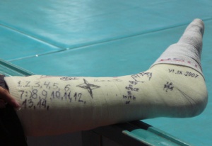 Травмите в Слънчев бряг са скъпо удоволствие: 540 лева за гипсиран крак